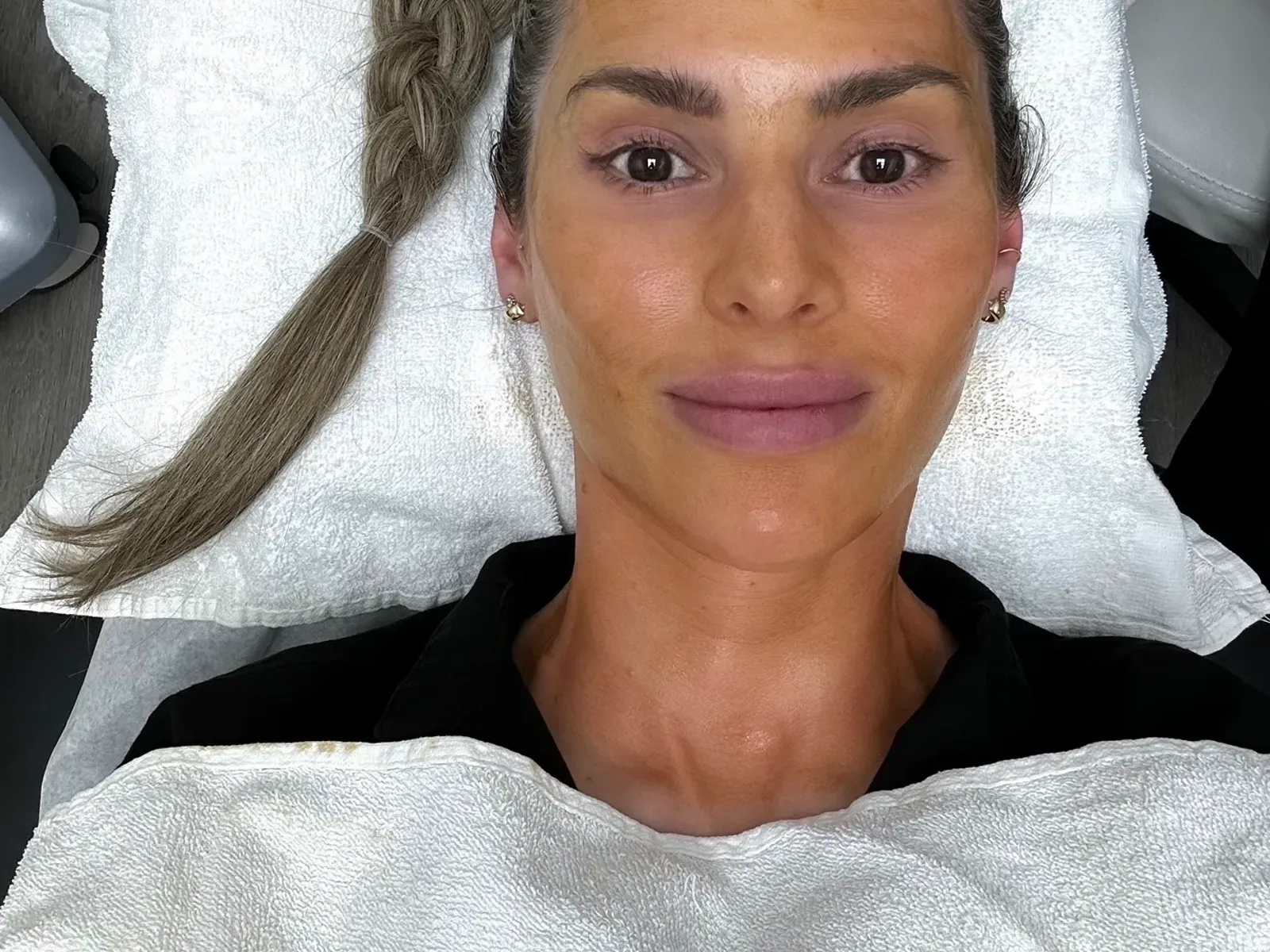 A patient with a towel wrap resting on the treatment bed after a medical peel at Ageless Living