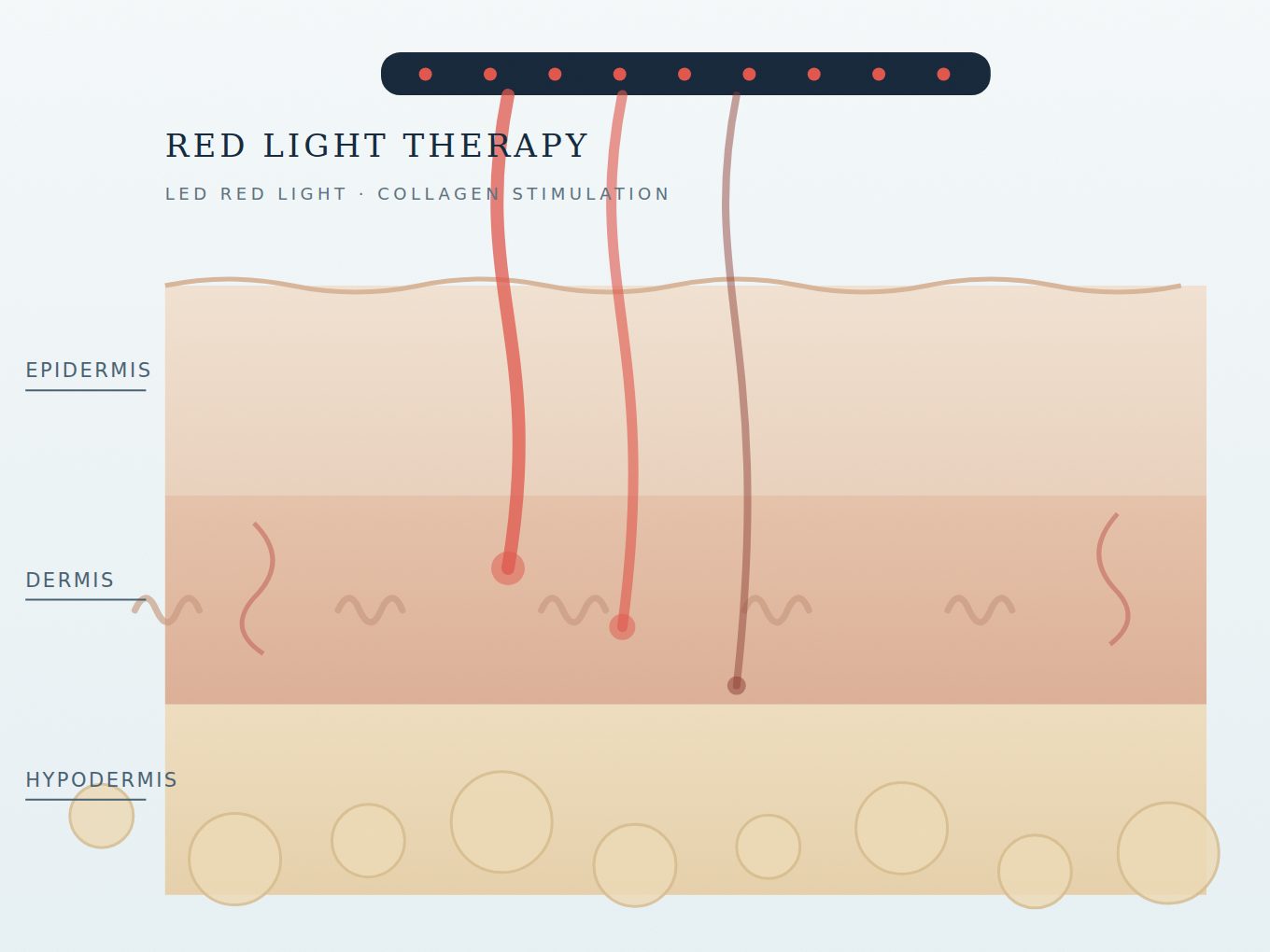 Cross-section of skin showing red light from an LED array reaching the epidermis, dermis and hypodermis